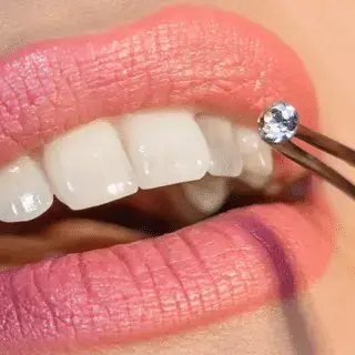 Choiche of teeth jewelry