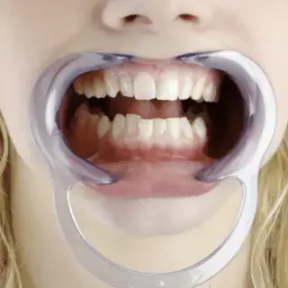 teeth jewelry procedure Mouth Retractor