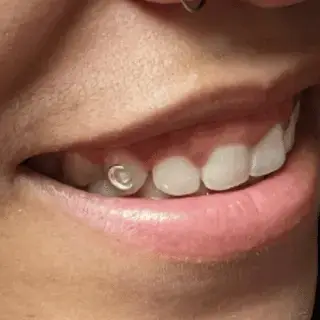 Teeth jewelry final result