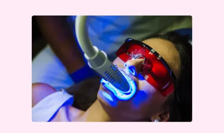 dental whitening lausanne geneva zoom lamp