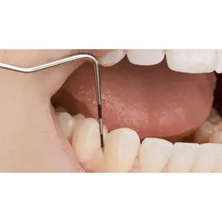 dental cleaning geneva lausanne checkup