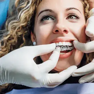 invisalign geneva visit