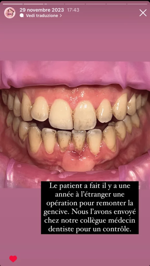 Etude Cas Controle Dentiste