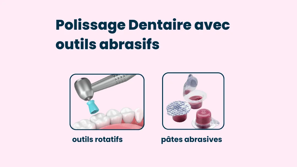 Polissage Dentaire avec Outils Abrasifs