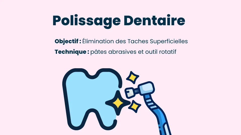 Qu est-ce que le polissage dentaire